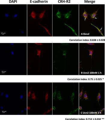 CRH-R2 signalling modulates feeding and circadian gene expression in hypothalamic mHypoA-2/30 neurons